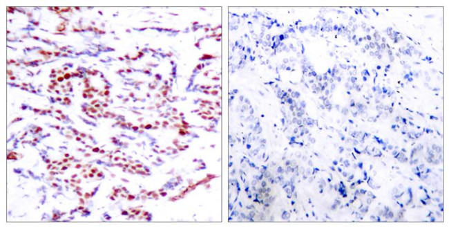 Phospho-ATF2 (Thr53, Thr71) Antibody in Immunohistochemistry (Paraffin) (IHC (P))