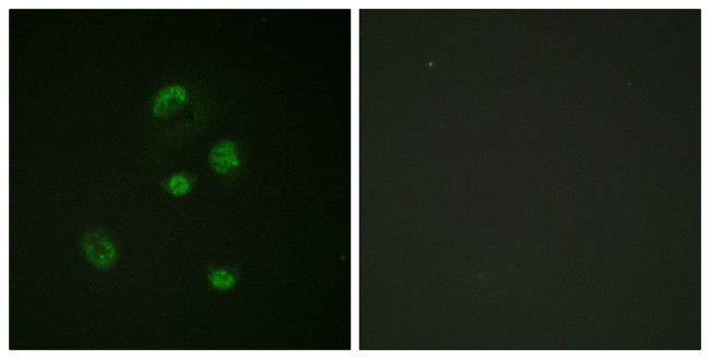 Phospho-CHOP (Ser30) Antibody in Immunocytochemistry (ICC/IF)