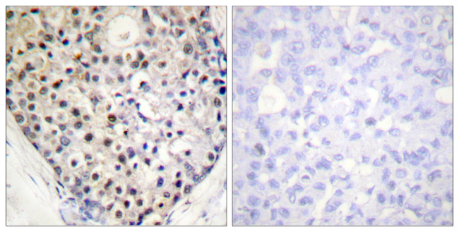 Phospho-CHOP (Ser30) Antibody in Immunohistochemistry (Paraffin) (IHC (P))