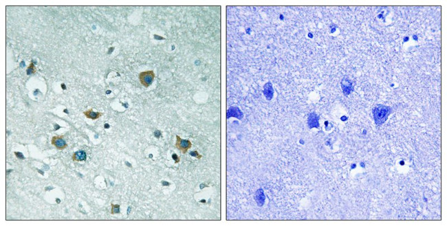 Phospho-CRMP2 (Thr509) Antibody in Immunohistochemistry (Paraffin) (IHC (P))