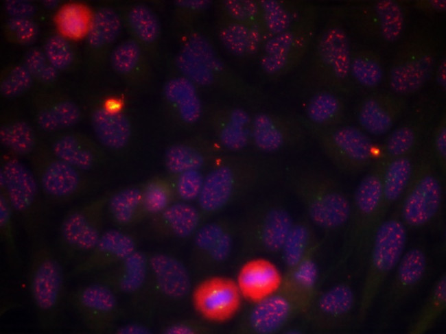 Phospho-ELK1 (Thr417) Antibody in Immunocytochemistry (ICC/IF)