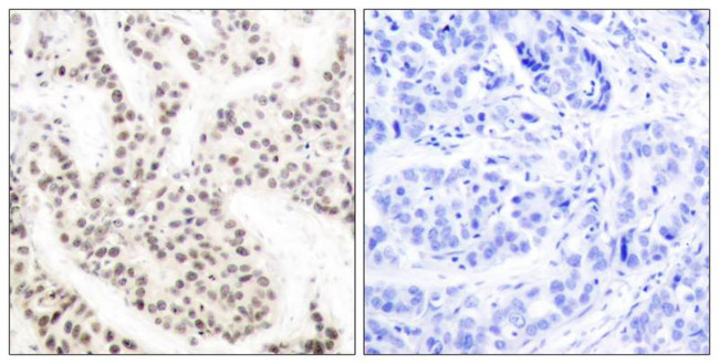 Phospho-ELK1 (Thr417) Antibody in Immunohistochemistry (Paraffin) (IHC (P))