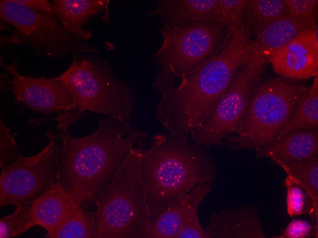 Phospho-Estrogen Receptor alpha (Ser167) Antibody in Immunocytochemistry (ICC/IF)