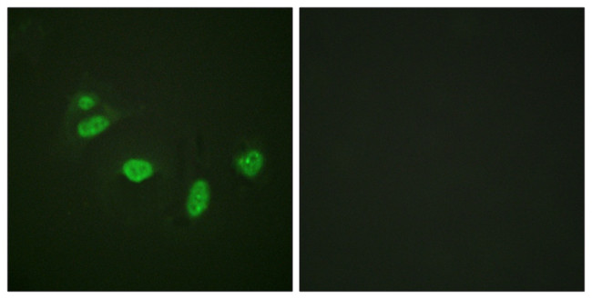 Phospho-ETS1 (Thr38) Antibody in Immunocytochemistry (ICC/IF)