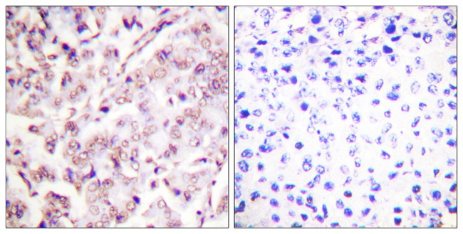 Phospho-ETS1 (Thr38) Antibody in Immunohistochemistry (Paraffin) (IHC (P))