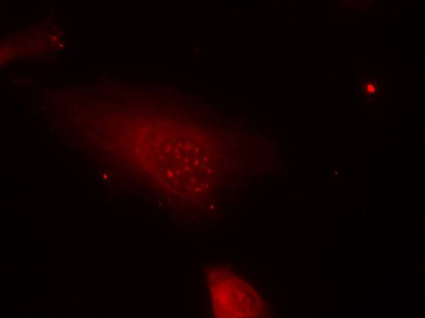 Phospho-FOXO1 (Ser319) Antibody in Immunocytochemistry (ICC/IF)