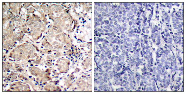 Phospho-FOXO1 (Ser319) Antibody in Immunohistochemistry (Paraffin) (IHC (P))