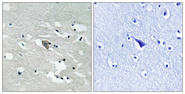 Phospho-VEGF Receptor 1 (Tyr1048) Antibody in Immunohistochemistry (Paraffin) (IHC (P))