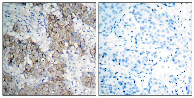 Phospho-IGF1R beta (Tyr1161) Antibody in Immunohistochemistry (Paraffin) (IHC (P))