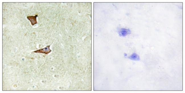 Phospho-IGF2R (Ser2409) Antibody in Immunohistochemistry (Paraffin) (IHC (P))