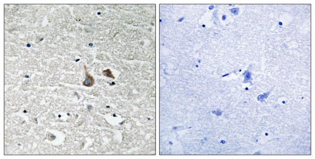 Phospho-IRAK1 (Ser376) Antibody in Immunohistochemistry (Paraffin) (IHC (P))