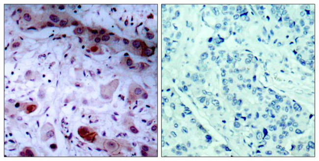 Phospho-JAK1 (Tyr1022) Antibody in Immunohistochemistry (Paraffin) (IHC (P))