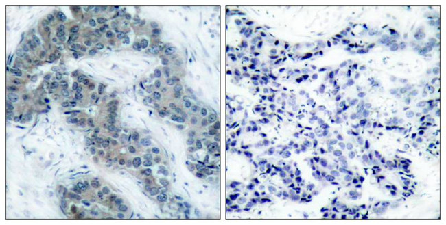 Phospho-JAK2 (Tyr1007) Antibody in Immunohistochemistry (Paraffin) (IHC (P))