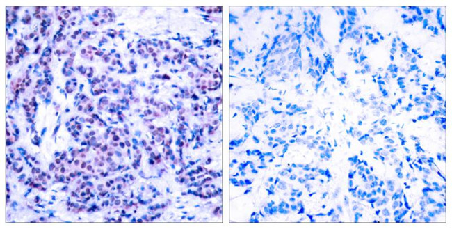 Phospho-JunD (Ser255) Antibody in Immunohistochemistry (Paraffin) (IHC (P))