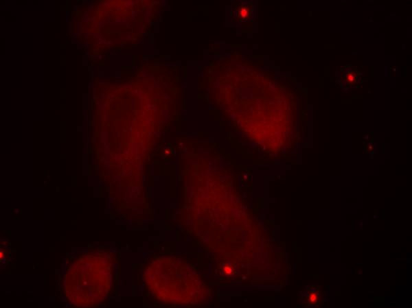 Phospho-LIMK1 (Thr508) Antibody in Immunocytochemistry (ICC/IF)