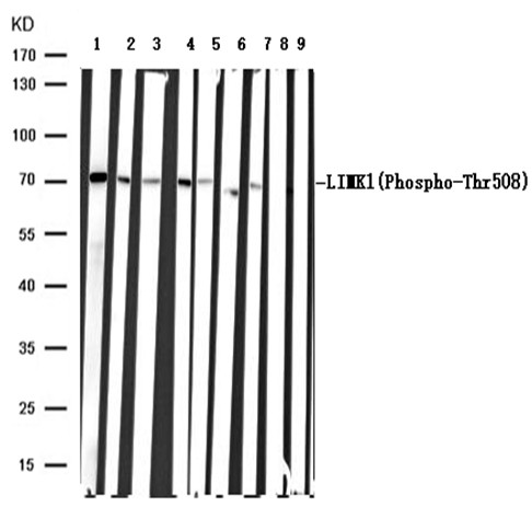 Phospho-LIMK1 (Thr508) Antibody in Immunohistochemistry (Paraffin) (IHC (P))