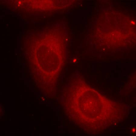 Phospho-LIMK2 (Thr505) Antibody in Immunocytochemistry (ICC/IF)