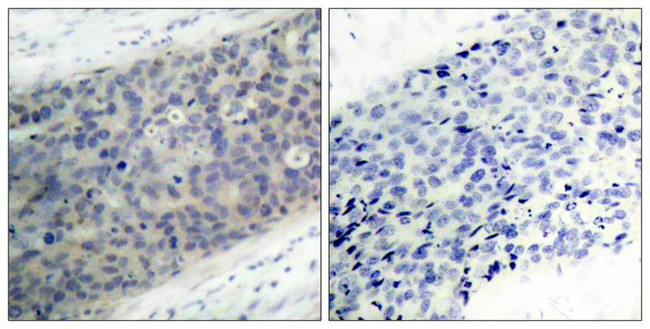 Phospho-LIMK2 (Thr505) Antibody in Immunohistochemistry (Paraffin) (IHC (P))