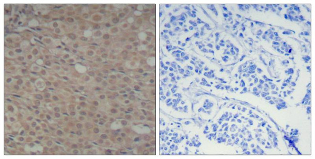 Phospho-SMAD3 (Ser425) Antibody in Immunohistochemistry (Paraffin) (IHC (P))