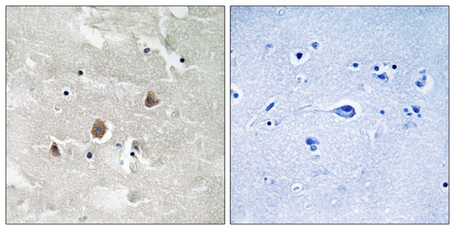 Phospho-MEKK1 (Thr1402) Antibody in Immunohistochemistry (Paraffin) (IHC (P))