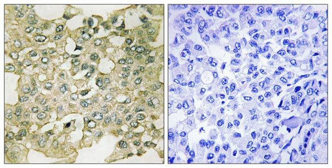 Phospho-PKMYT1 (Ser83) Antibody in Immunohistochemistry (Paraffin) (IHC (P))