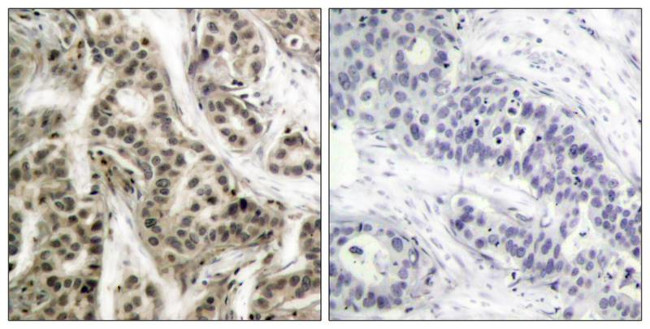 Phospho-NFkB p105/p50 (Ser337) Antibody in Immunohistochemistry (Paraffin) (IHC (P))