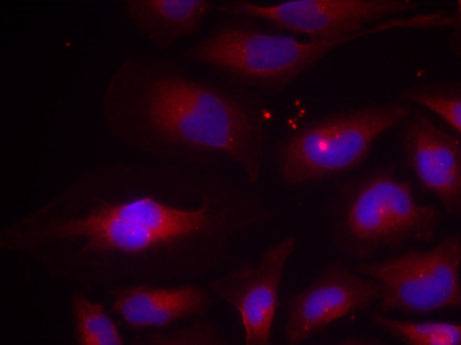 Phospho-NFkB p100 (Ser870) Antibody in Immunocytochemistry (ICC/IF)