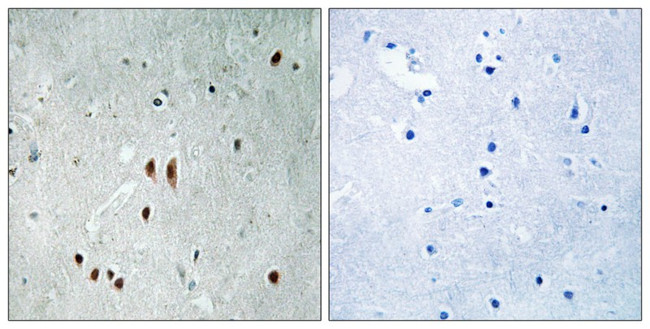 Phospho-CNOT2 (Ser101) Antibody in Immunohistochemistry (Paraffin) (IHC (P))