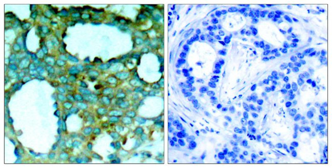 Phospho-PAK1 (Thr212) Antibody in Immunohistochemistry (Paraffin) (IHC (P))