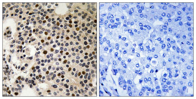 Phospho-PAK2 (Ser197) Antibody in Immunohistochemistry (Paraffin) (IHC (P))