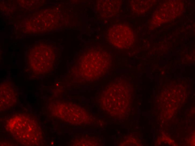 Phospho-PKC beta (Thr641) Antibody in Immunocytochemistry (ICC/IF)