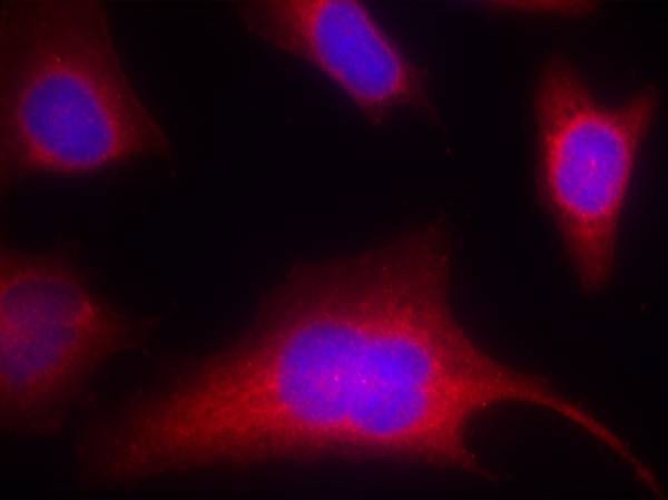 Phospho-PKC mu (Ser910) Antibody in Immunocytochemistry (ICC/IF)