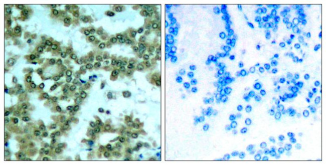 Phospho-PKC theta (Ser676) Antibody in Immunohistochemistry (Paraffin) (IHC (P))