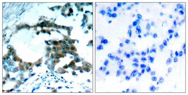 Phospho-PKC theta (Ser695) Antibody in Immunohistochemistry (Paraffin) (IHC (P))