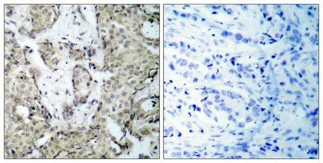 Phospho-MEK3 (Ser189) Antibody in Immunohistochemistry (Paraffin) (IHC (P))