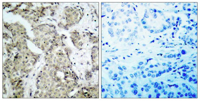 Phospho-MEK6 (Ser207) Antibody in Immunohistochemistry (Paraffin) (IHC (P))