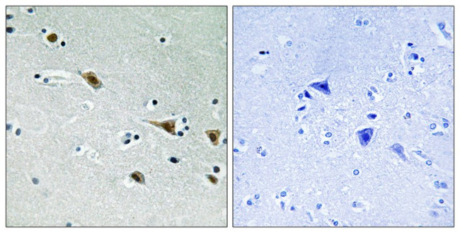 Phospho-MEK7 (Ser271) Antibody in Immunohistochemistry (Paraffin) (IHC (P))