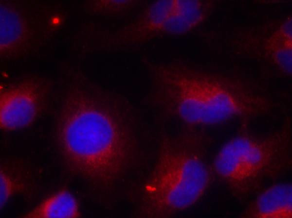 Phospho-PTEN (Ser380) Antibody in Immunocytochemistry (ICC/IF)