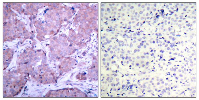 Phospho-PTEN (Ser380) Antibody in Immunohistochemistry (Paraffin) (IHC (P))