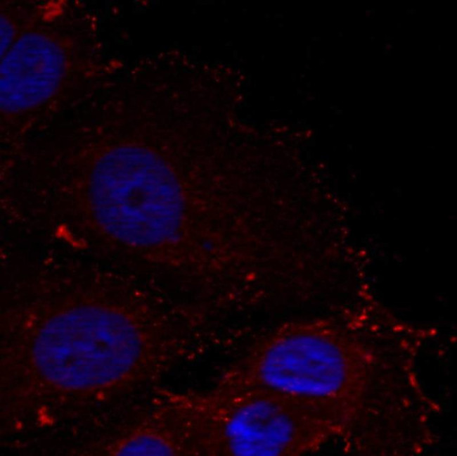 Phospho-Paxillin (Tyr88) Antibody in Immunocytochemistry (ICC/IF)