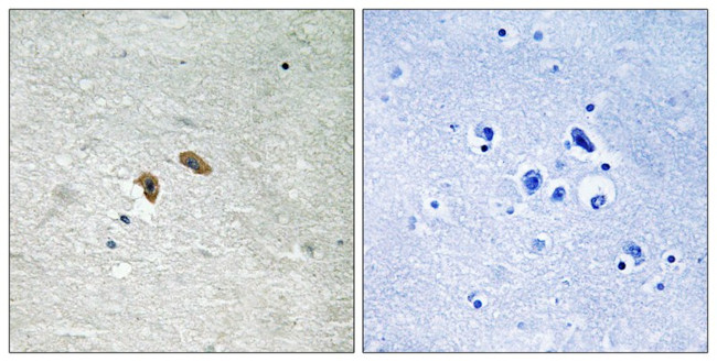 Phospho-c-Raf (Thr269) Antibody in Immunohistochemistry (Paraffin) (IHC (P))