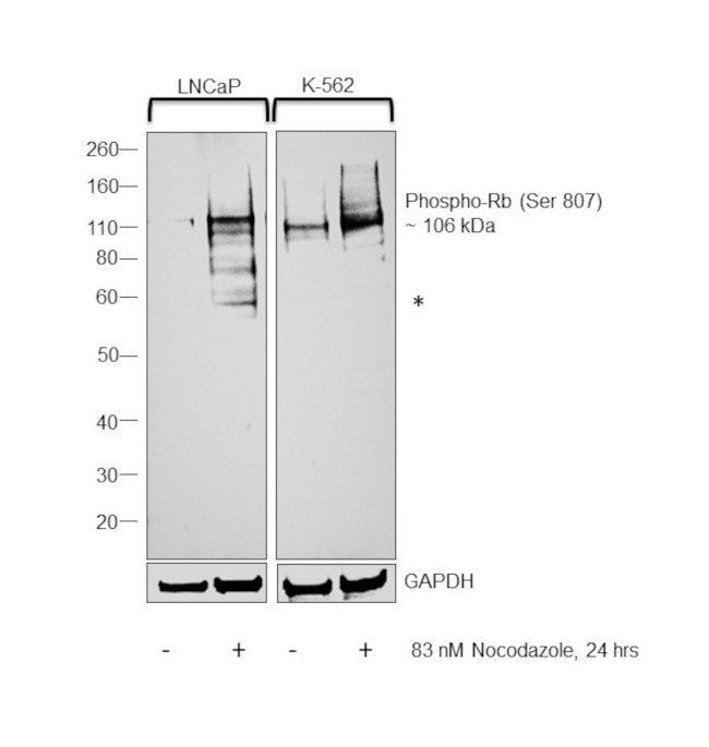 Phospho-Rb (Ser807) Antibody in Western Blot (WB)