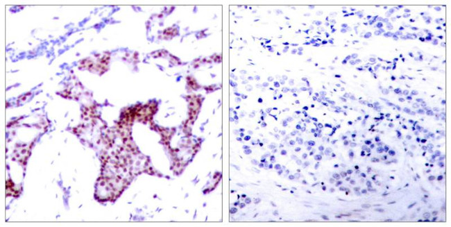 Phospho-NFkB p65 (Ser276) Antibody in Immunohistochemistry (Paraffin) (IHC (P))