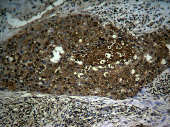 Phospho-NFkB p65 (Ser276) Antibody in Immunohistochemistry (Paraffin) (IHC (P))