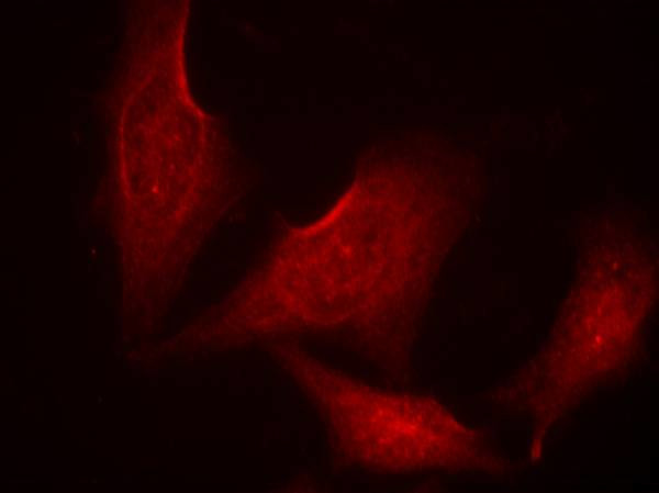 Phospho-NFkB p65 (Ser311) Antibody in Immunocytochemistry (ICC/IF)