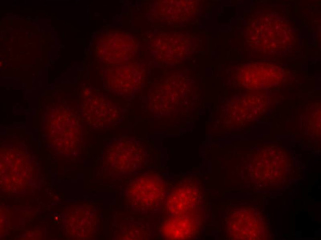 Phospho-p70 S6 Kinase (Thr421) Antibody in Immunocytochemistry (ICC/IF)