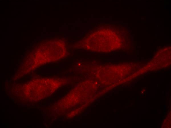 Phospho-SHC (Tyr427) Antibody in Immunocytochemistry (ICC/IF)