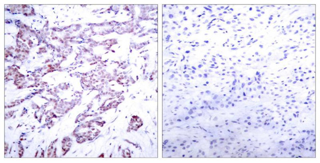 Phospho-STAT6 (Thr645) Antibody in Immunohistochemistry (Paraffin) (IHC (P))