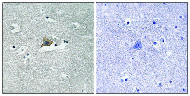 Phospho-Claudin 5 (Tyr217) Antibody in Immunohistochemistry (Paraffin) (IHC (P))