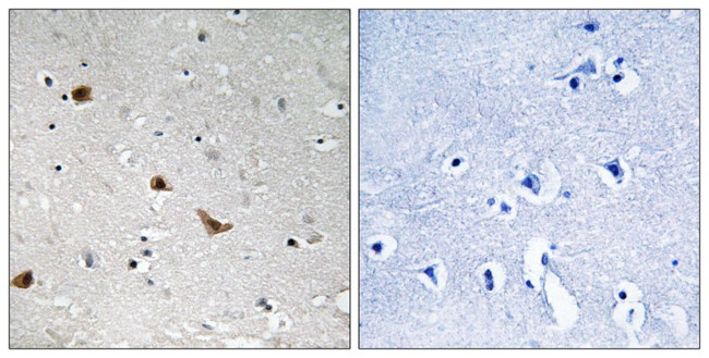 Phospho-IKK gamma (Ser376) Antibody in Immunohistochemistry (Paraffin) (IHC (P))